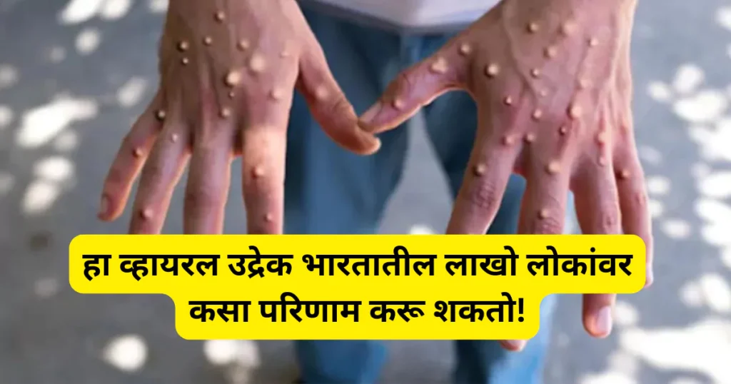 Monkeypox in Marathi: